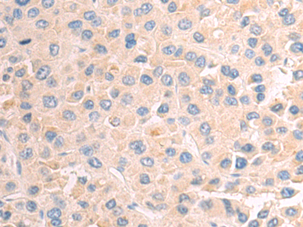 Rabbit Polyclonal Antibody to ADAMTS16