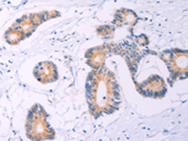 Rabbit Polyclonal Antibody to ADCY5