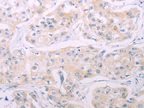 Rabbit Polyclonal Antibody to ADCY7