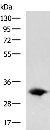 Rabbit Polyclonal Antibody to SLC25A4