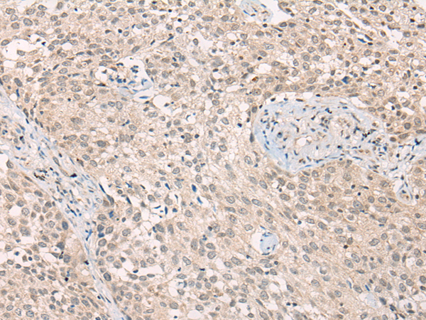 Rabbit Polyclonal Antibody to ADORA1