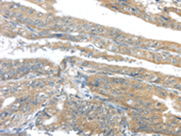 Rabbit Polyclonal Antibody to AKT2