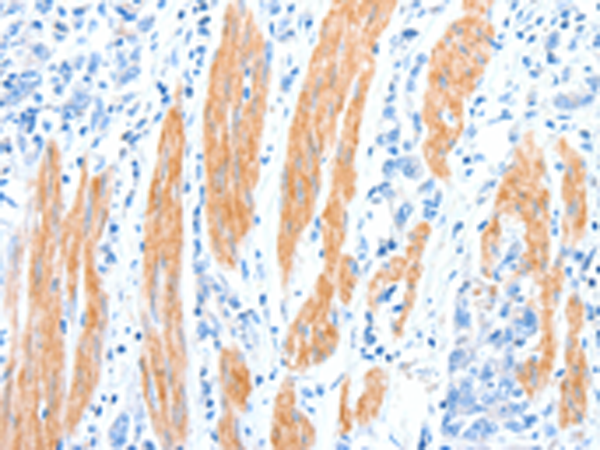 Rabbit Polyclonal Antibody to AKT3