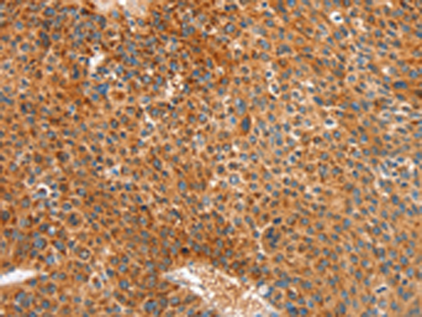 Rabbit Polyclonal Antibody to ALDH1A2