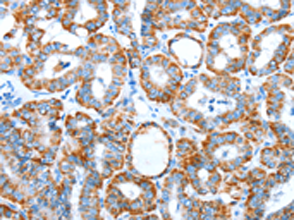 Rabbit Polyclonal Antibody to ALDH5A1