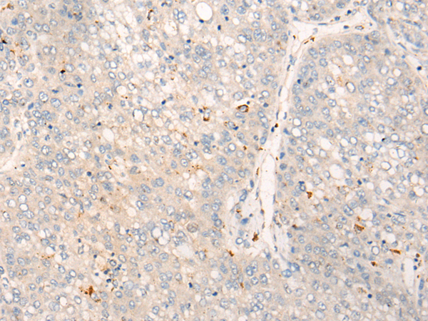 Rabbit Polyclonal Antibody to ALK