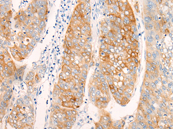 Rabbit Polyclonal Antibody to AIFM2