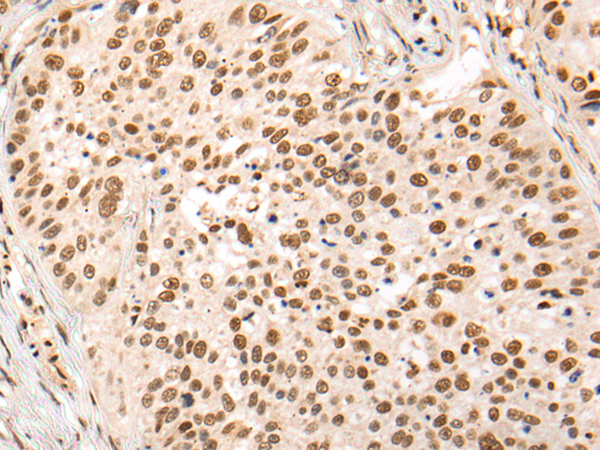 Rabbit Polyclonal Antibody to HOXA7
