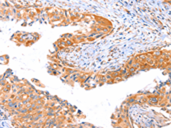 Rabbit Polyclonal Antibody to AP1B1