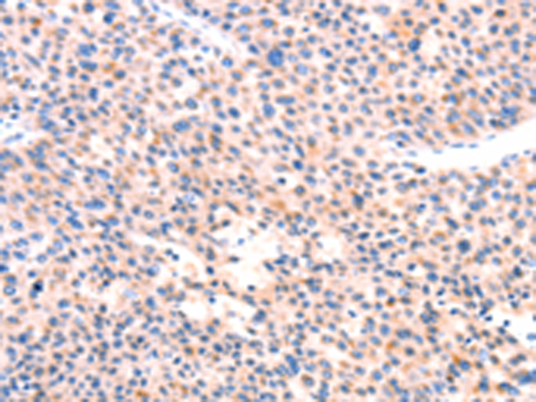 Rabbit Polyclonal Antibody to APBA2