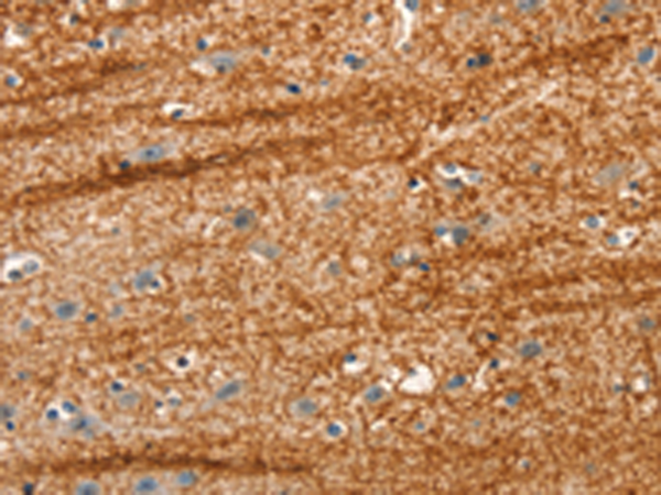 Rabbit Polyclonal Antibody to APC