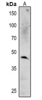 Rabbit Polyclonal Antibody to MPK6