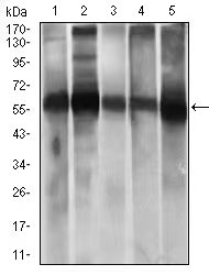 Mouse Monoclonal Antibody to ALDH2