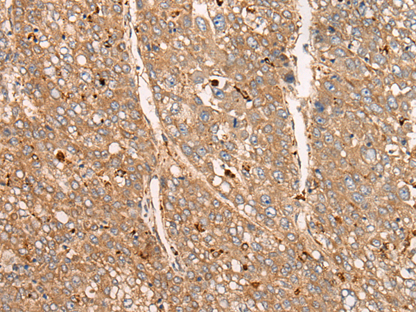 Rabbit Polyclonal Antibody to APOBEC1