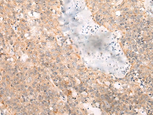 Rabbit Polyclonal Antibody to LRP8