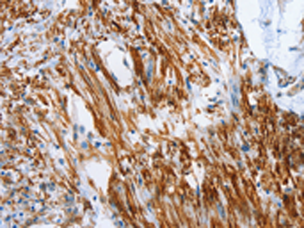 Rabbit Polyclonal Antibody to SHROOM2
