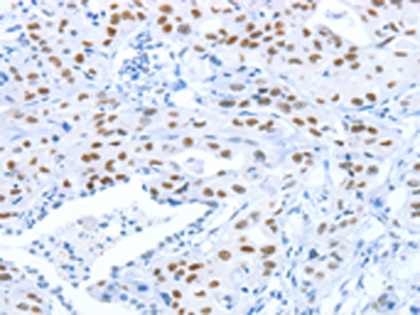 Rabbit Polyclonal Antibody to ARID1A