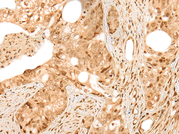 Rabbit Polyclonal Antibody to ARID1B