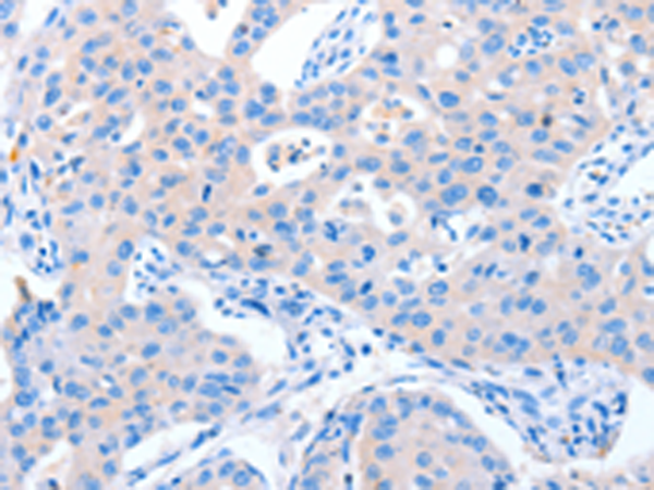 Rabbit Polyclonal Antibody to NUAK1