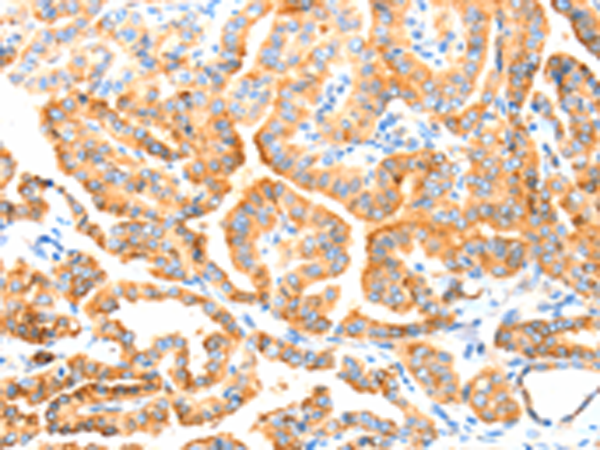 Rabbit Polyclonal Antibody to MANF