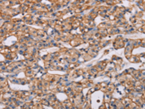 Rabbit Polyclonal Antibody to ARAP1