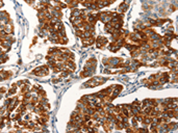 Rabbit Polyclonal Antibody to AGO4