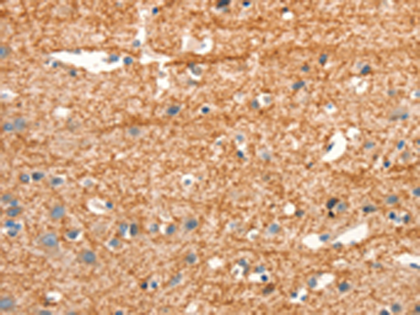 Rabbit Polyclonal Antibody to ARHGEF11