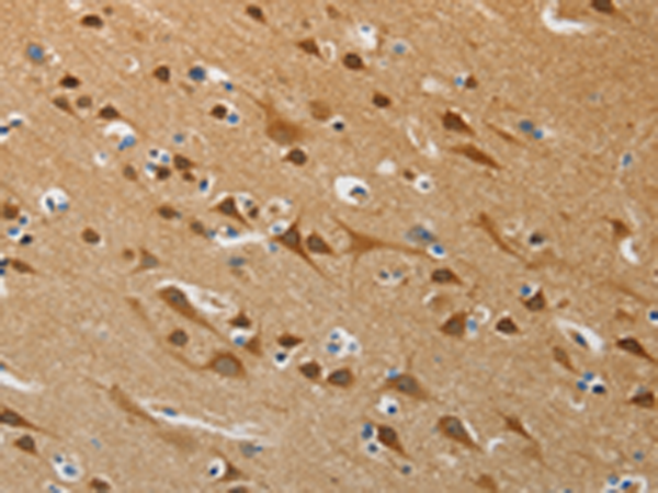 Rabbit Polyclonal Antibody to ATG4B