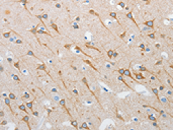 Rabbit Polyclonal Antibody to INTS1