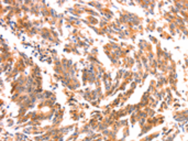 Rabbit Polyclonal Antibody to NES