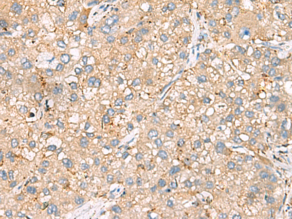 Rabbit Polyclonal Antibody to PIWIL3