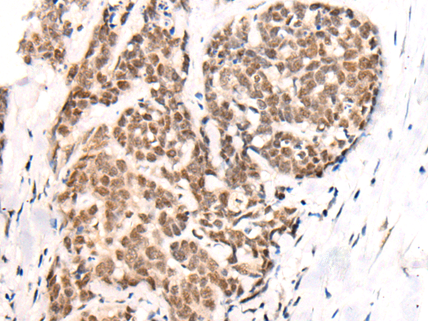 Rabbit Polyclonal Antibody to PIAS3