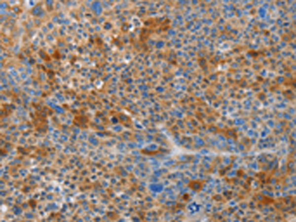 Rabbit Polyclonal Antibody to HTRA3