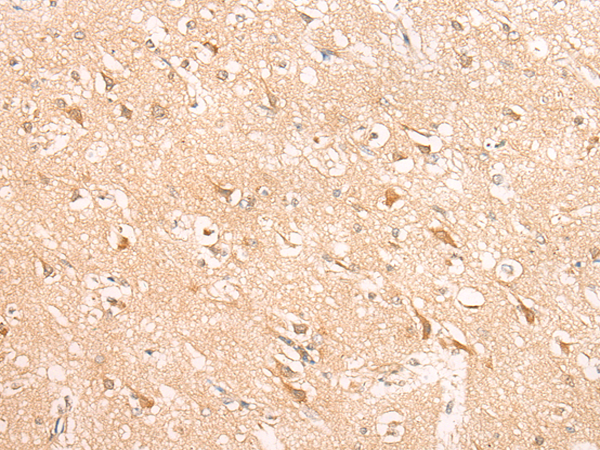 Rabbit Polyclonal Antibody to HIRA