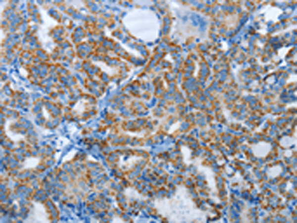 Rabbit Polyclonal Antibody to AGL