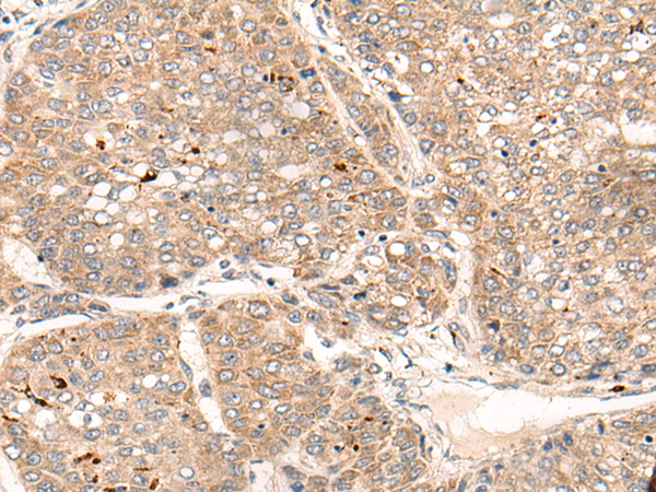 Rabbit Polyclonal Antibody to ZNF467