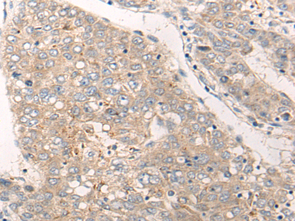 Rabbit Polyclonal Antibody to SLC9A3R1