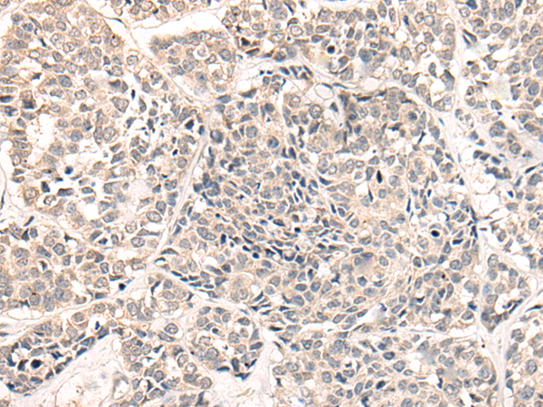 Rabbit Polyclonal Antibody to NRG2