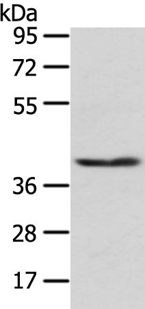 Rabbit Polyclonal Antibody to PHKG1