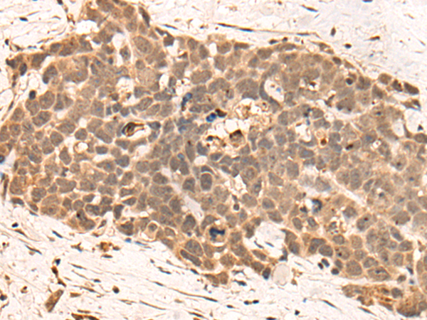 Rabbit Polyclonal Antibody to CLK2