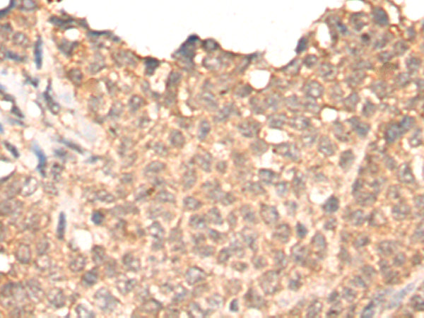 Rabbit Polyclonal Antibody to HIPK3
