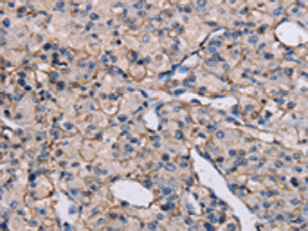 Rabbit Polyclonal Antibody to EPHA7
