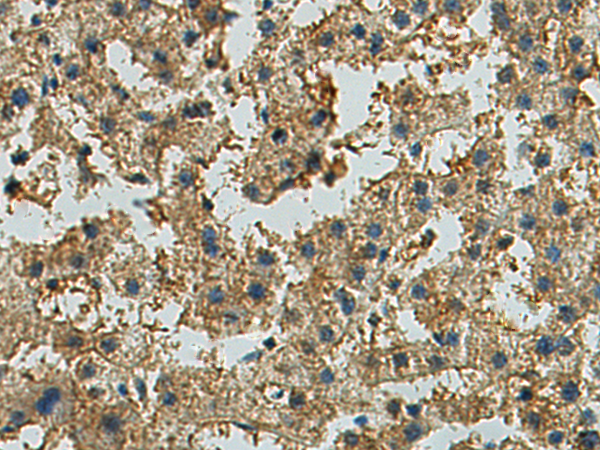 Rabbit Polyclonal Antibody to EPHA3