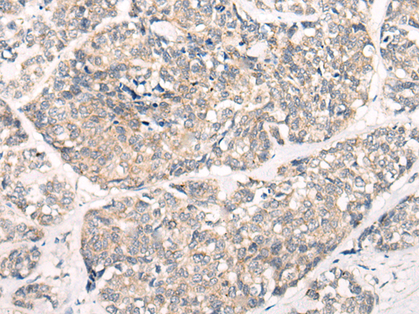 Rabbit Polyclonal Antibody to EPHA6