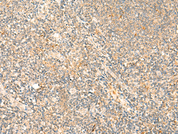 Rabbit Polyclonal Antibody to PIK3R1