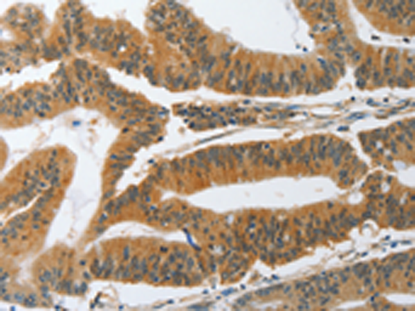 Rabbit Polyclonal Antibody to PIK3R3