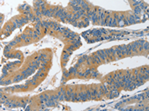 Rabbit Polyclonal Antibody to PIK3R4