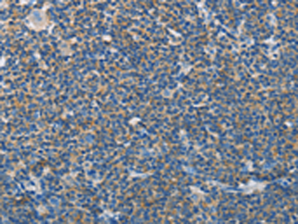 Rabbit Polyclonal Antibody to NEK5