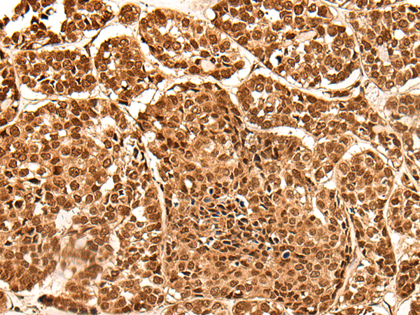 Rabbit Polyclonal Antibody to NEK7