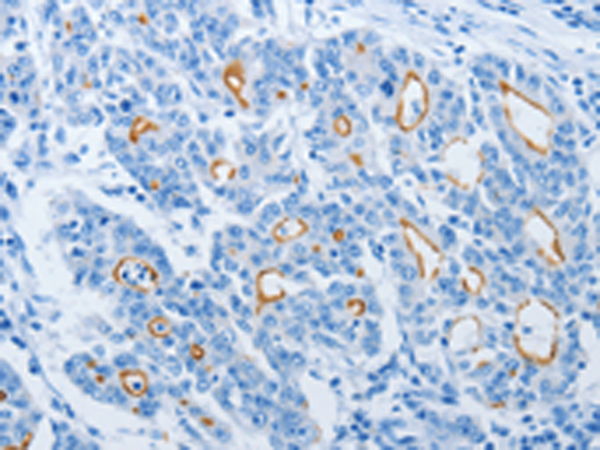 Rabbit Polyclonal Antibody to NEK10